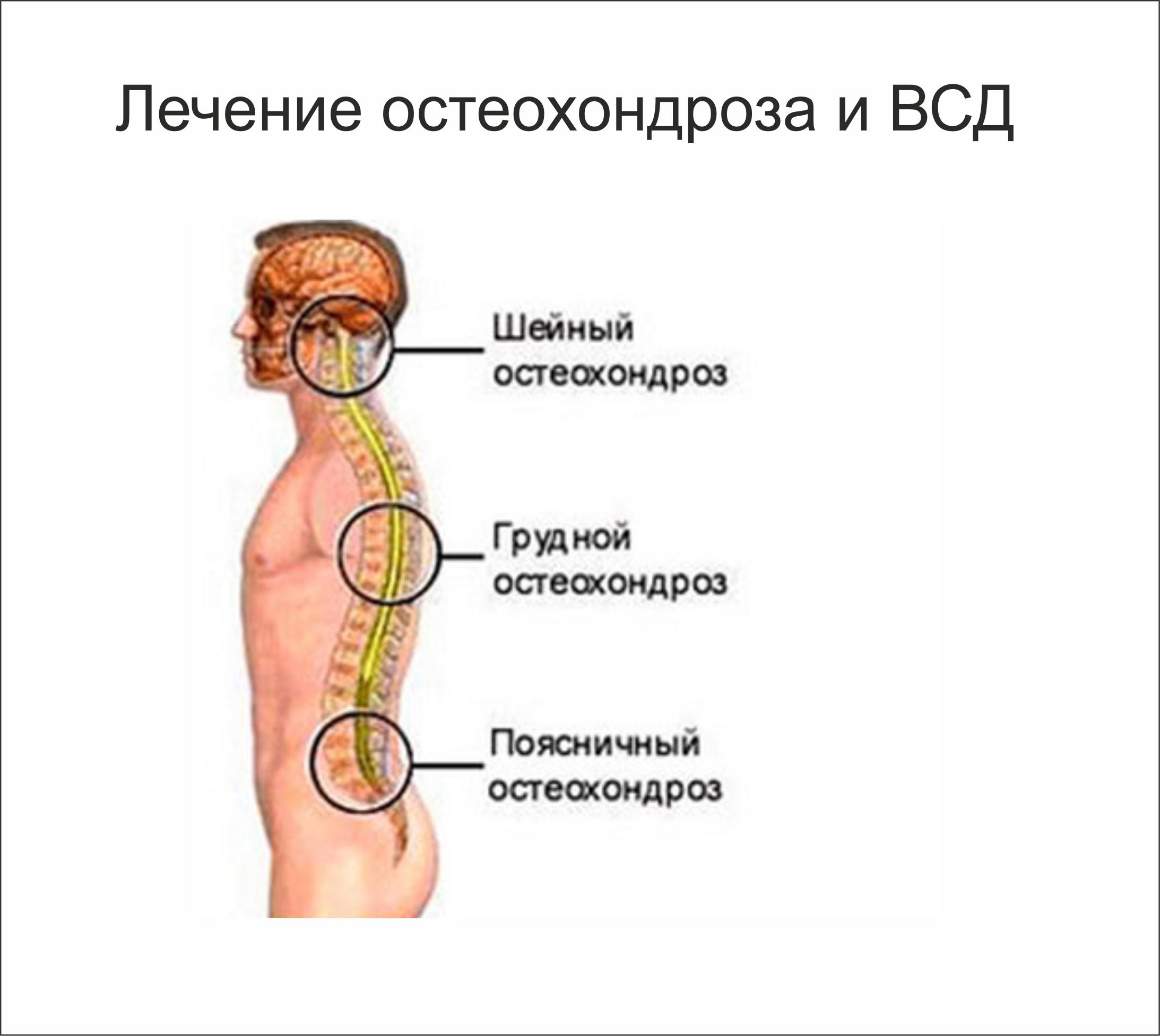 Что такое остеохондроз и как его лечить тазобедренный сустав Что такое остеохондроз и как его лечить тазобедренный сустав